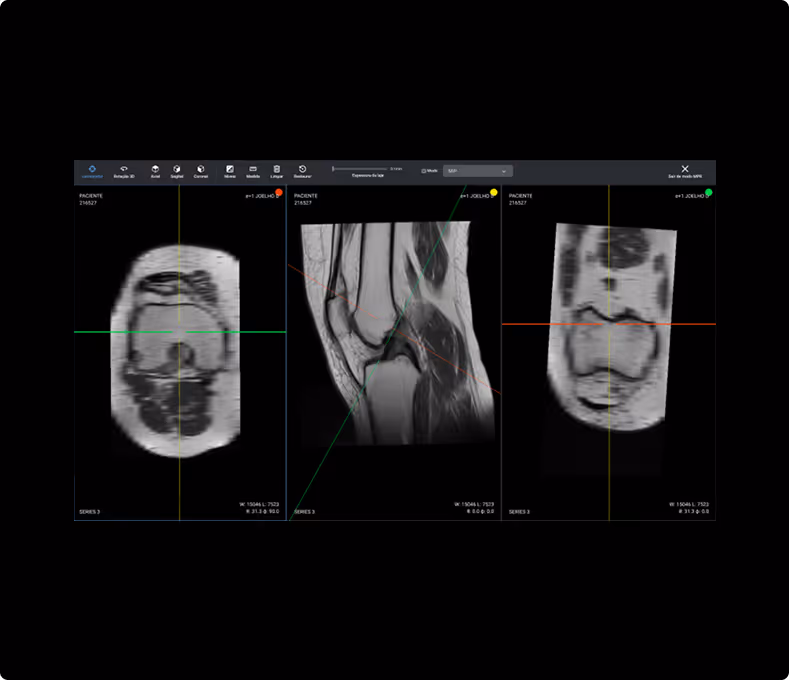 pantalla mip y mpr de MedCloud PACS