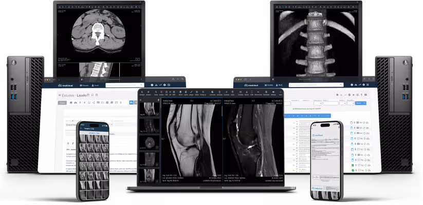 Computadores, laptop e celulares exibindo exames médicos digitais, incluindo imagens de ressonância magnética, tomografia computadorizada e laudos, representando tecnologia avançada para visualização e análise de imagens médicas.