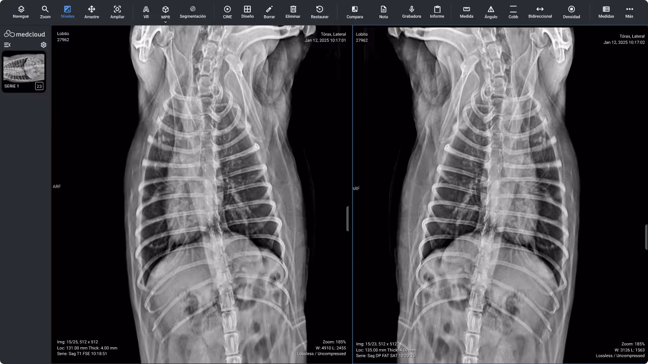 Radiografía de tórax lateral de un perro exhibida en un software de visualización médica, mostrando costillas, columna y órganos internos.