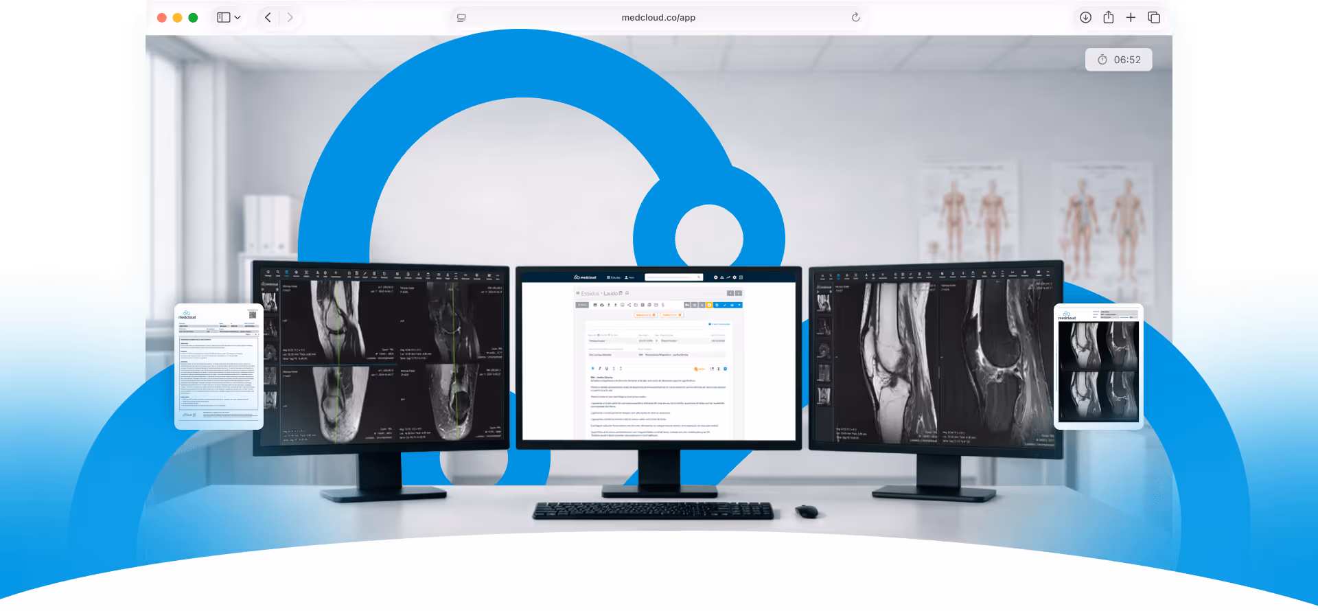 Estação de trabalho com três monitores exibindo exames de ressonância magnética e laudo médico digital, com documentos flutuantes ao redor.