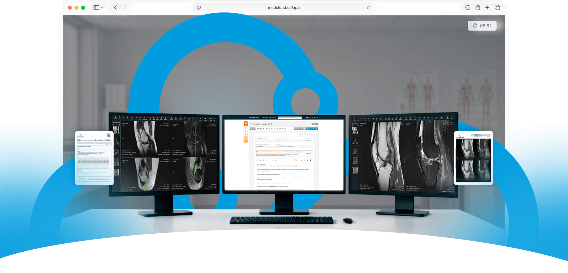 Estação de trabalho com três monitores exibindo exames de ressonância magnética e laudo médico digital, com documentos flutuantes ao redor.