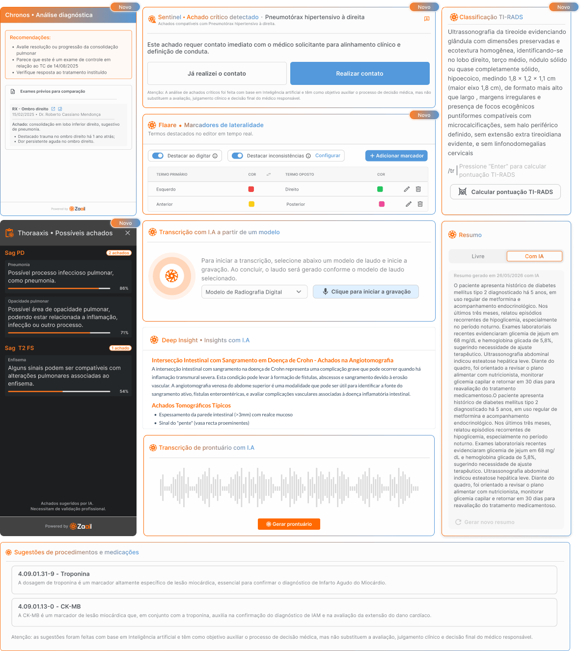 Imagem com 'Cards' de funcionabilidades de inteligencia artificial da Zaail