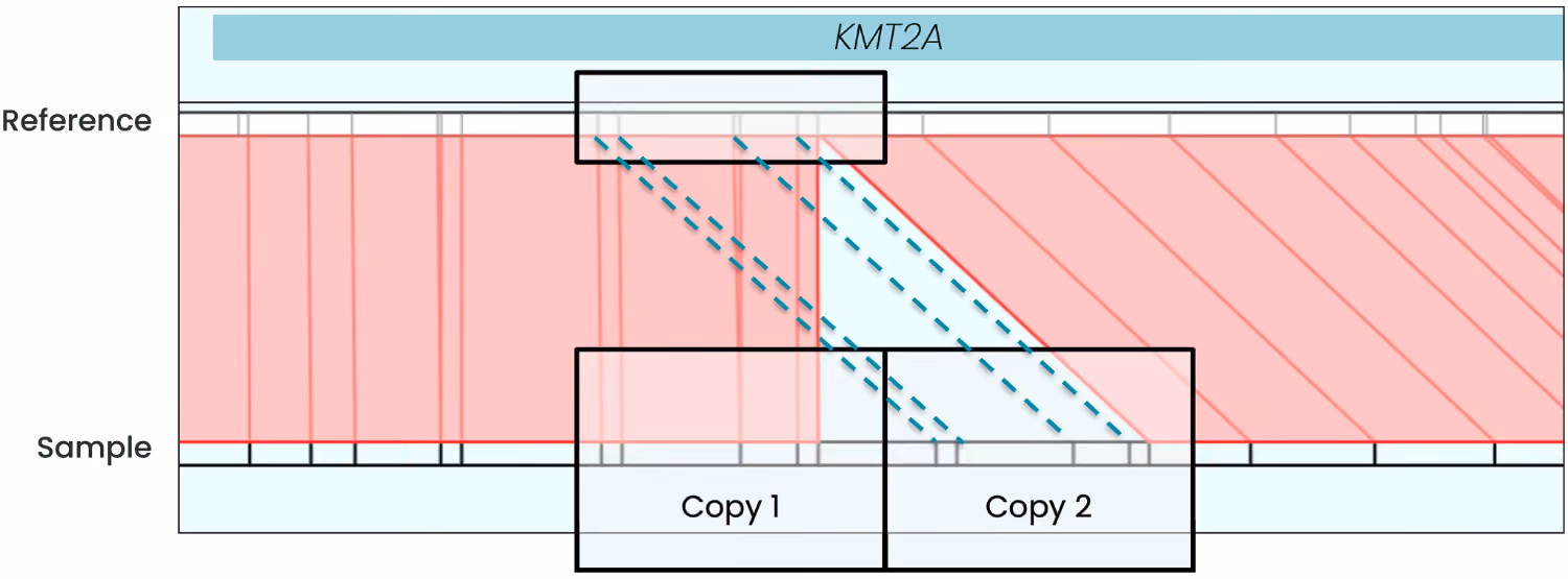 Figure 1. KMT2A partial tandem duplication (PTD) in an AML cell line (EOL-1) visualized in Human Chromosome Explorer® (HCE). In the reference contig (top), a single copy of the duplicated segment is present. In the sample contig (bottom), Copy 1 and Copy 2 each align back to the same reference interval (dashed lines), indicating a 22 kb tandem duplication at the KMT2A locus.