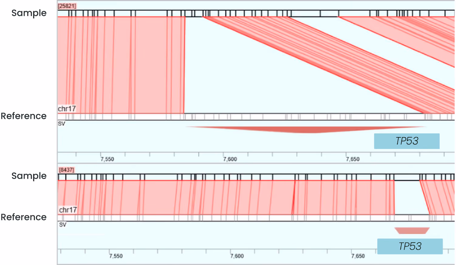 Figure 2. TP53 deletions in cancer cell line samples visualized in Human Chromosome Explorer® (HCE). (Top) In the HL-60 leukemia cell line, the Allele 1 track aligns to chromosome 17 with EGM tag spacings consistent with a large 87 kb TP53 deletion. (Bottom) In the H1299 cell line, the Allele 1 track shows EGM tag spacings consistent with a small 3.8 kb TP53 deletion overlapping exons 7 and 8. TP53 genes and deletions are represented as teal rectangles and red trapezoids, respectively.