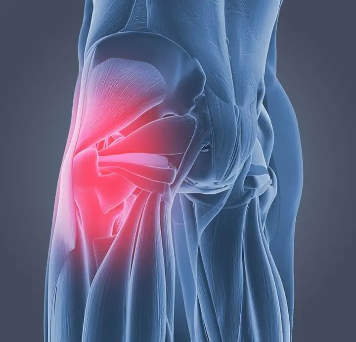 Pathologies les plus fréquentes de la hanche Dr Claire Supper docteur en traumatologie du sport et réadaptation sur Reims