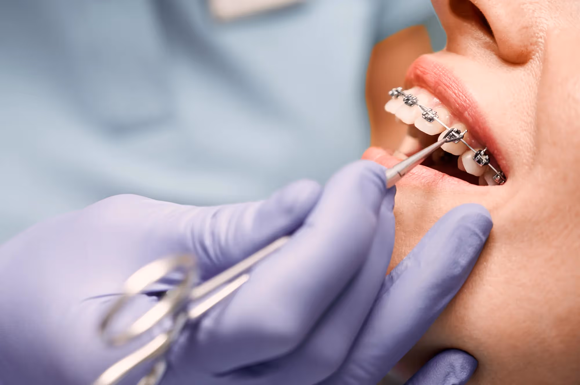 Orthodontics in Brunswick, OH