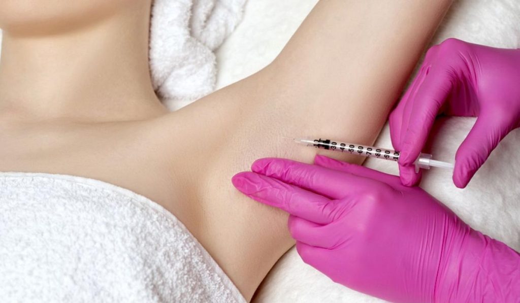 Underarm Botox