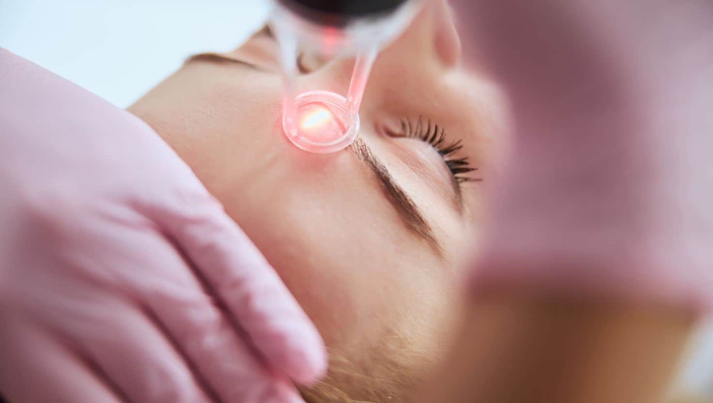 Fractional Laser
