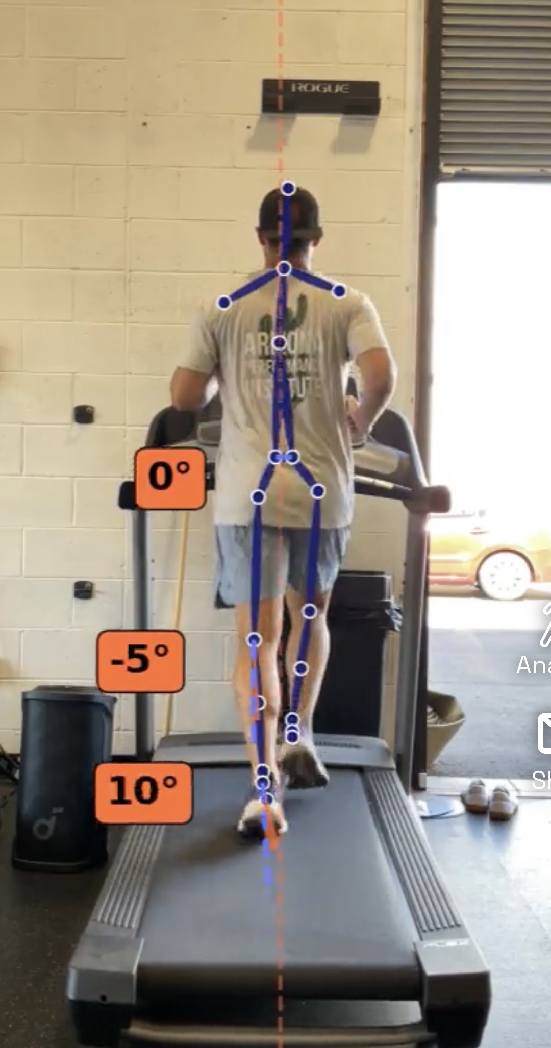 Unlock Your Best Run: How AZPI’s Running and Gait Analysis Helps You Move Better, Faster, and Pain-Free