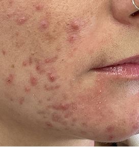 Before & After Image