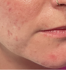 Before & After Image