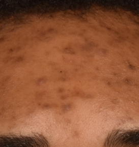 Before & After Image