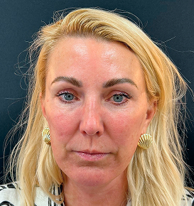 Before & After Image