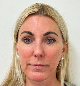 Before & After Image