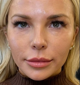 Before & After Image