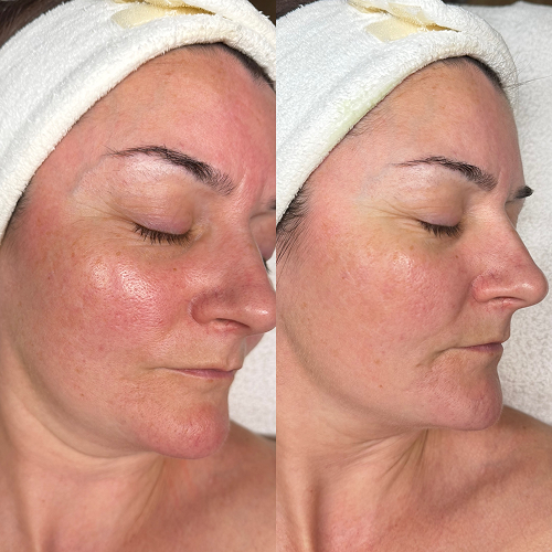 Before & After Image