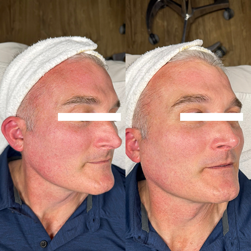 Before & After Image