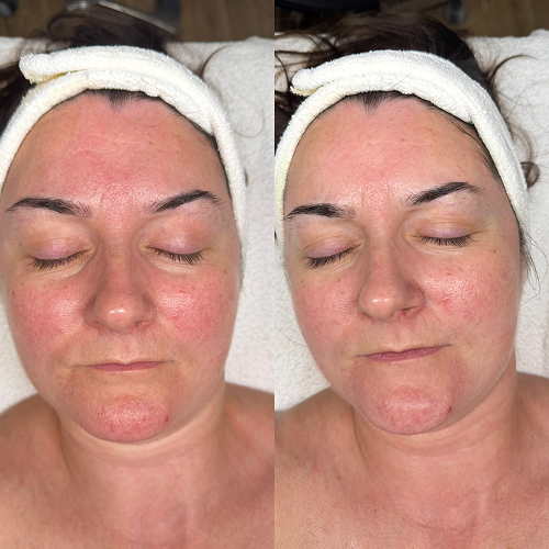 Before & After Image