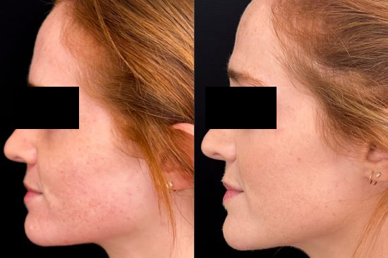 Before & After Image