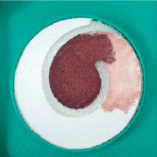 A sample collection device