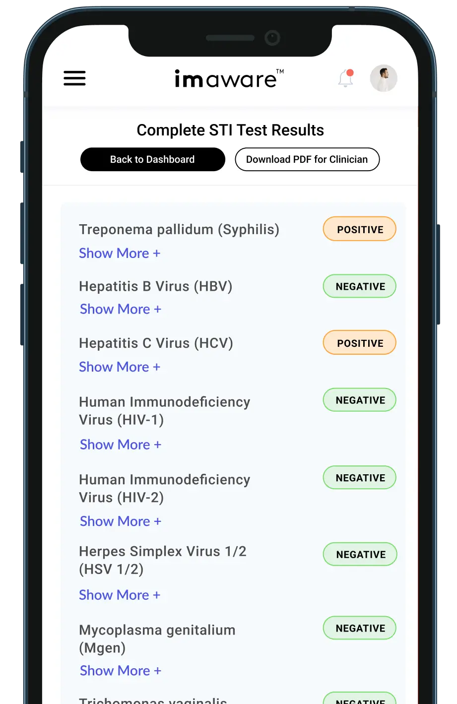 Mobile app screen showing a list of completed STI test results with positive and negative status indicators