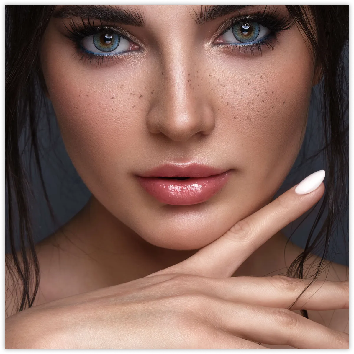 Woman with freckles and a smooth forehead, Dysport® wrinkle treatment in Chattanooga, TN