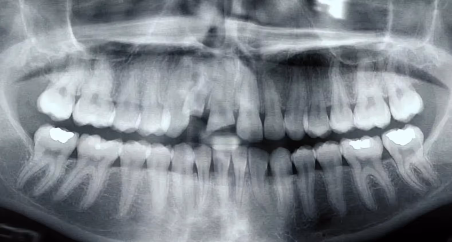 Video Blog: Dr. Vandervort Discusses the Treatment of Oral and Facial Injuries