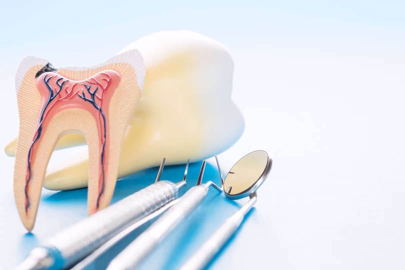 If Having a Root Canal Treatment Can’t Save Your Damaged Tooth, an Apicoectomy Often Can