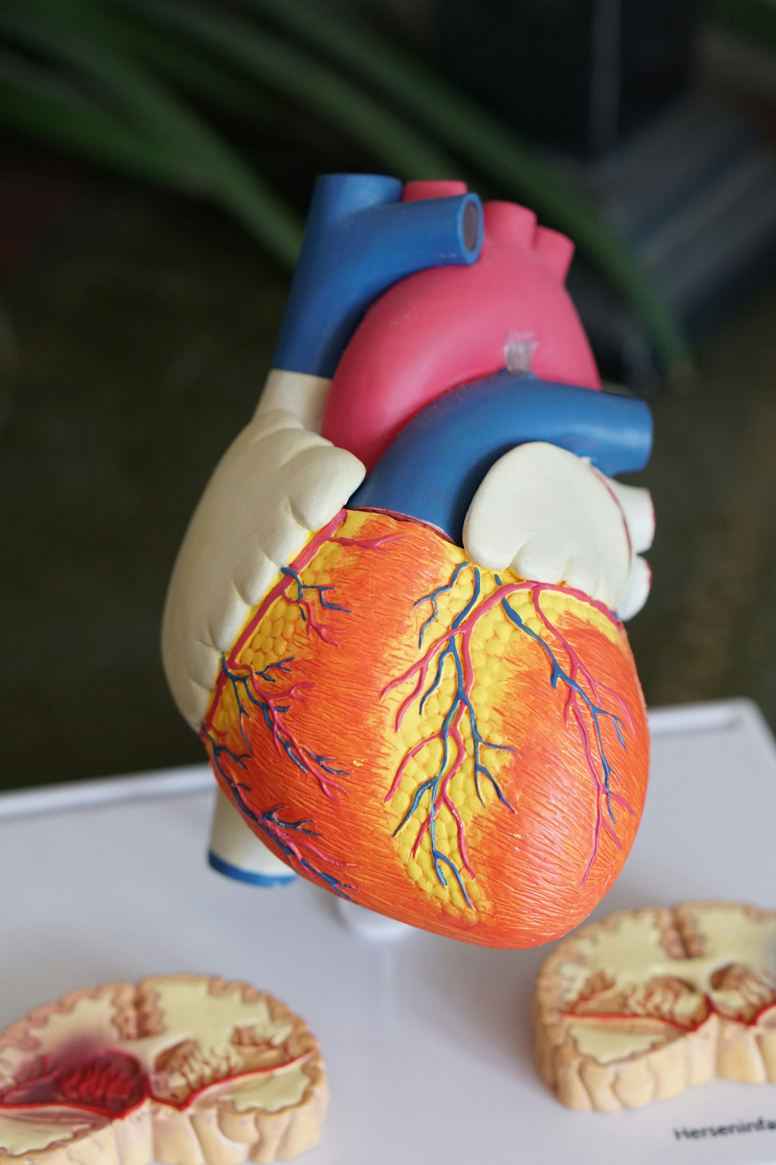 What's Actually Pinched When You Have a 'Pinched Nerve'