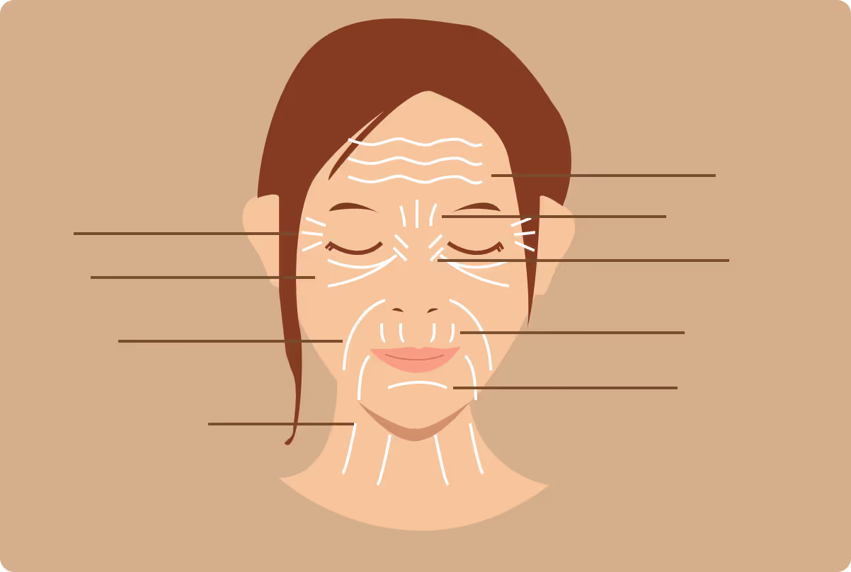 botox toronto