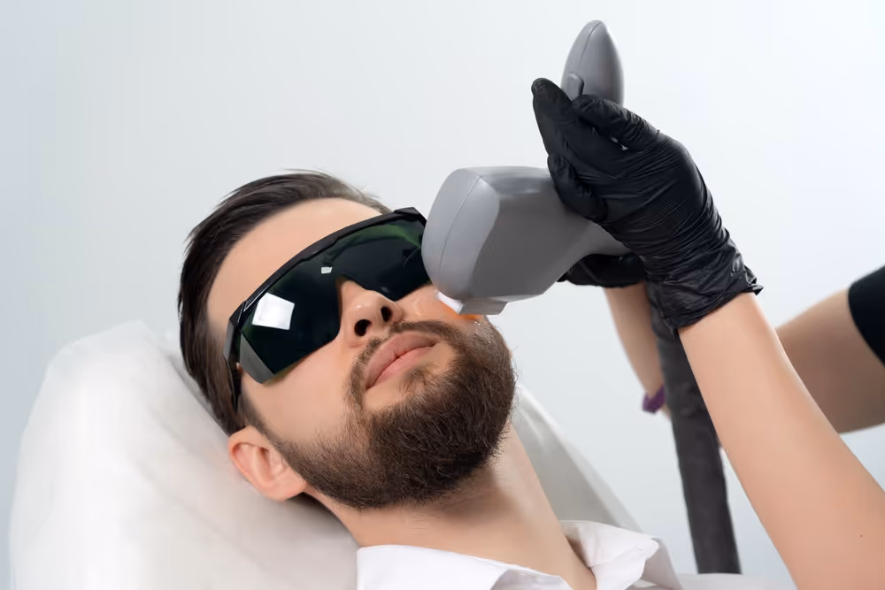 Laser hair removal Mississauga