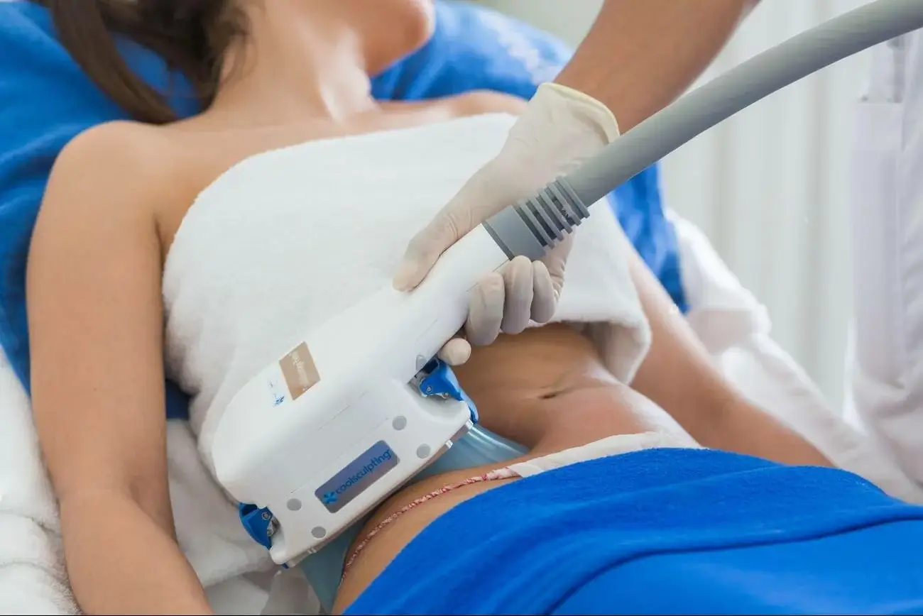 coolsculpting toronto
