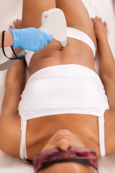 Laser Hair removal