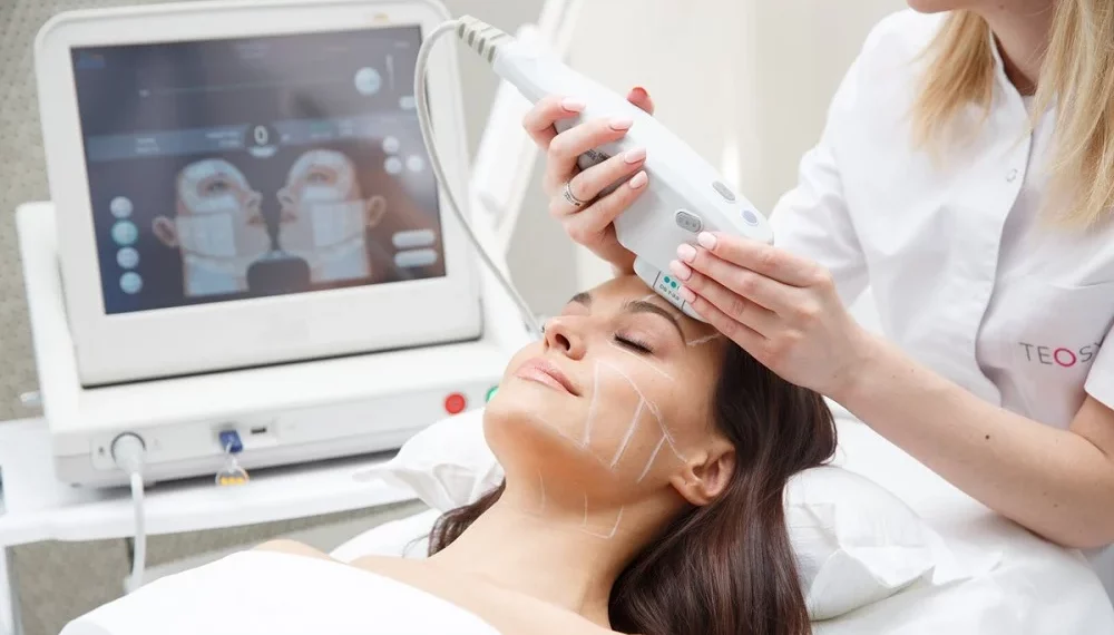 ultherapy totornto