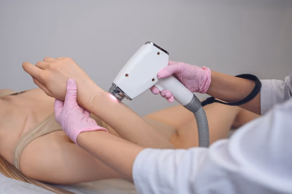 Laser hair removal