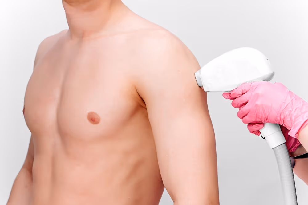 Laser hair removal in Richmond hill