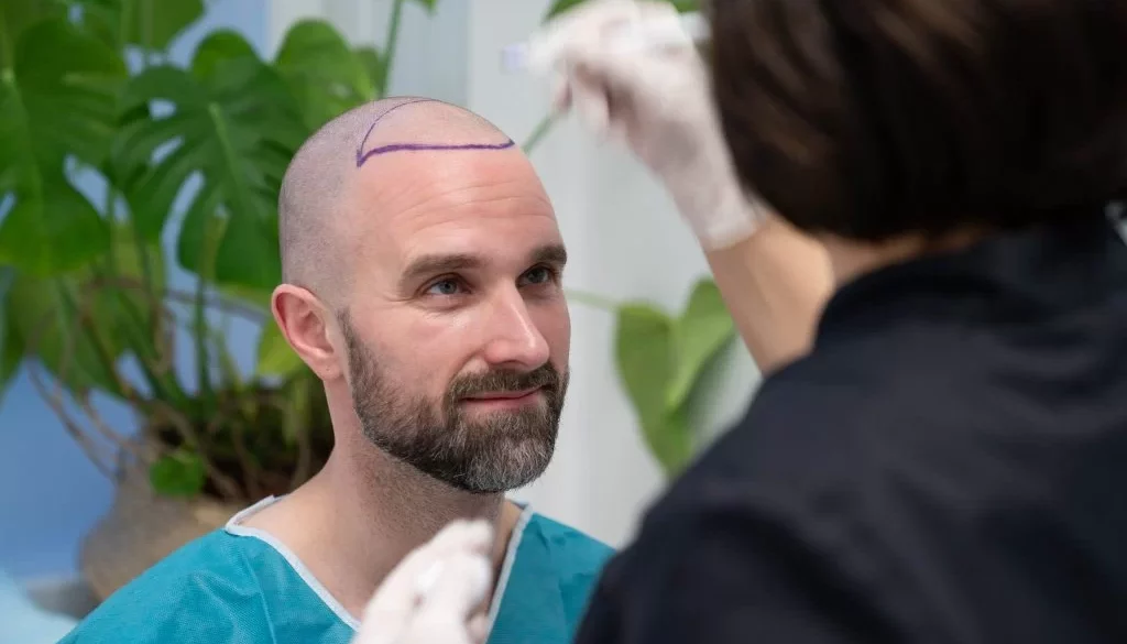 hair transplant in mississauga