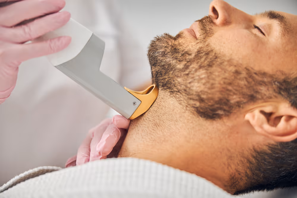 laser hair removal for beard sculpting