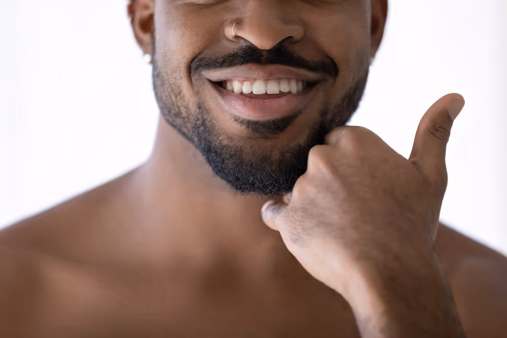 laser hair removal for beard sculpting