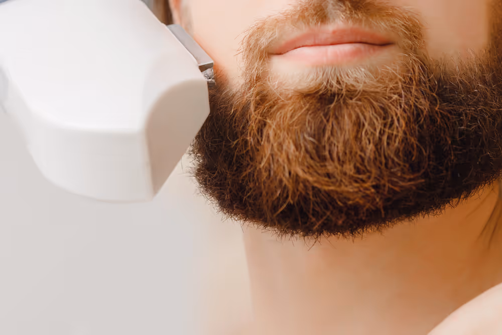 laser hair removal for beard sculpting toronto