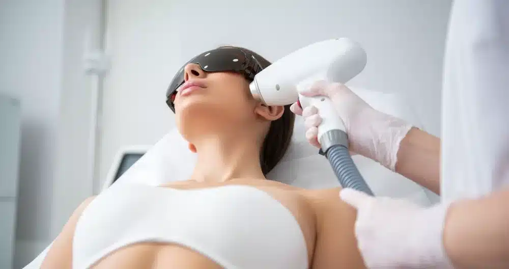 laser hair removal toronto