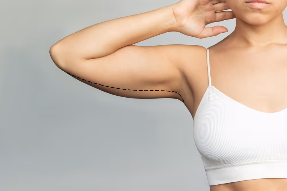 coolsculpting arm toronto
