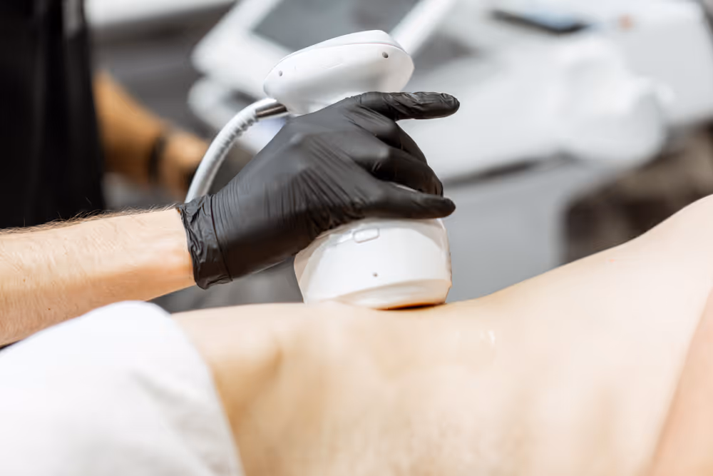 Coolsculpting pickering