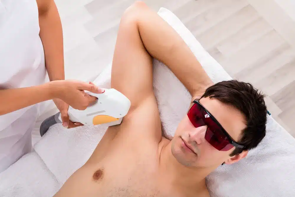 armpits laser hair removal for men