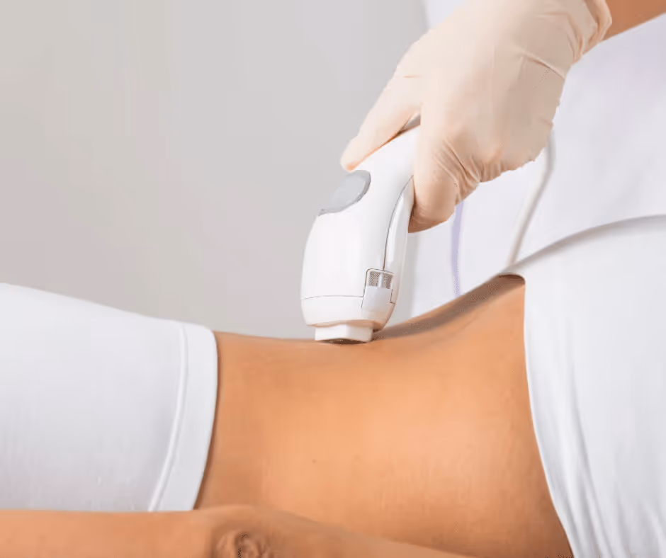 back laser hair removal