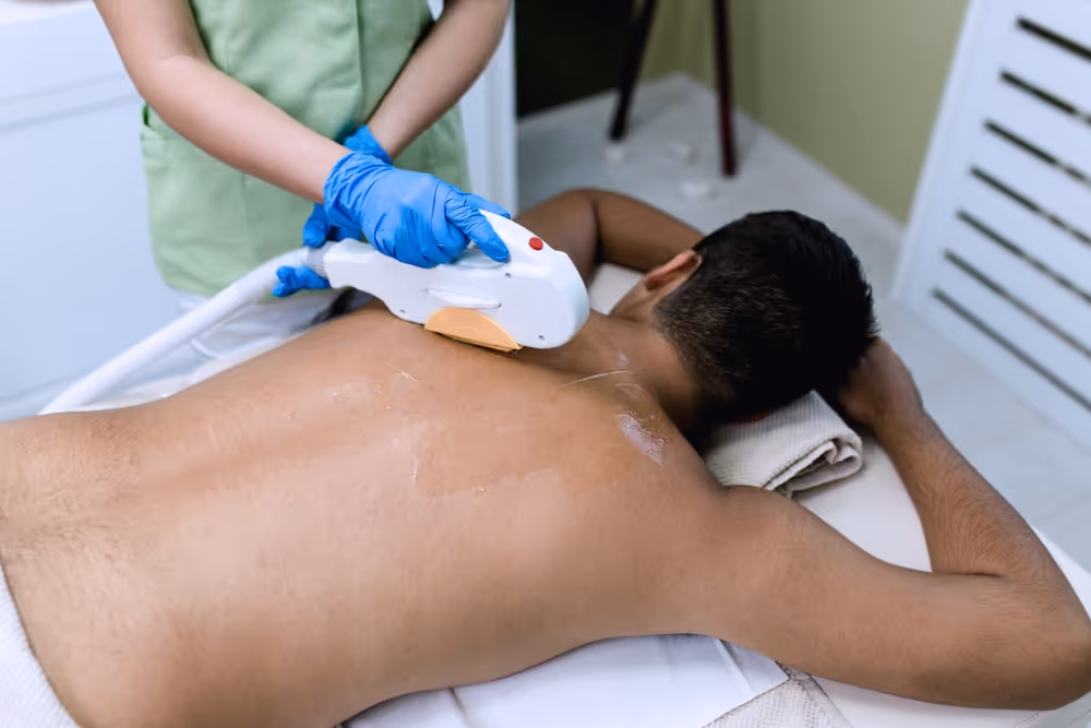 laser hair removal for male toronto