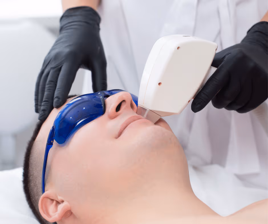laser hair removal face toronto