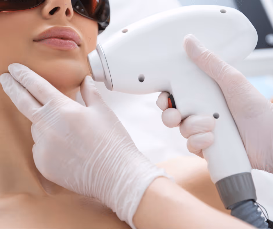laser hair removal for face women