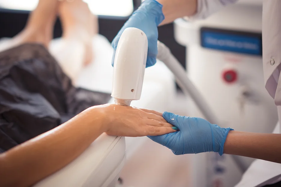 laser hair removal for hands