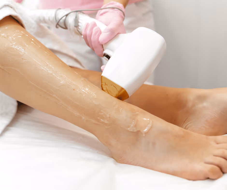 laser hair removal for legs